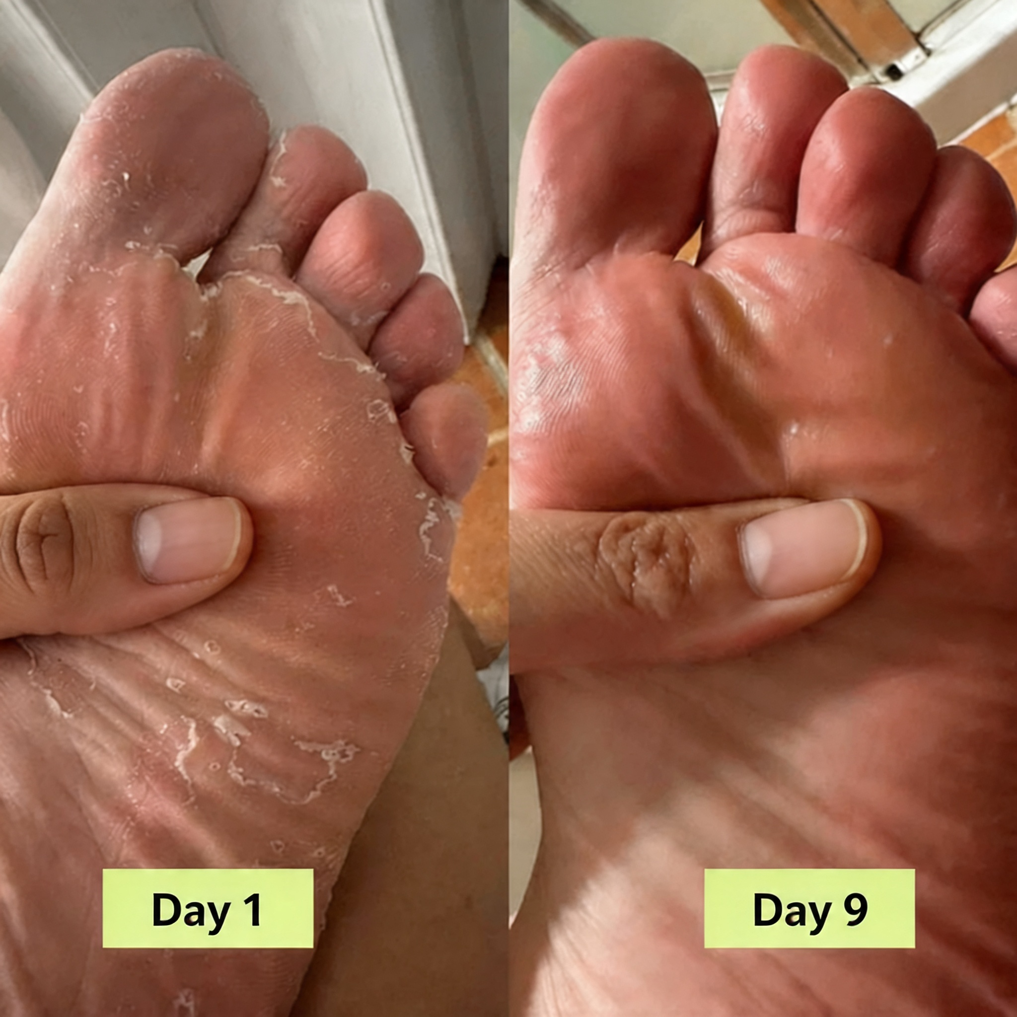 Serevia® Purifying Antifungal Soap