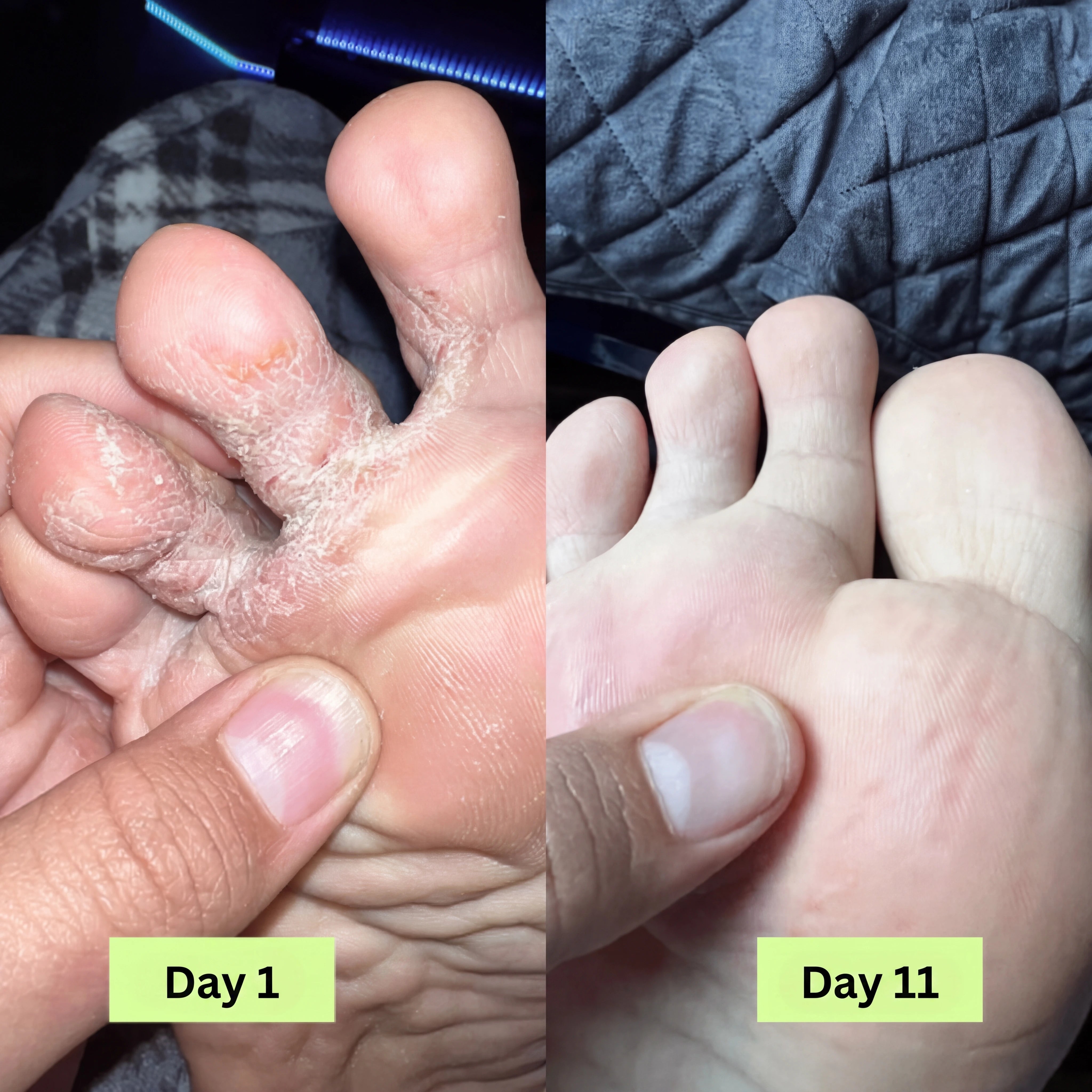 Serevia® Purifying Antifungal Soap