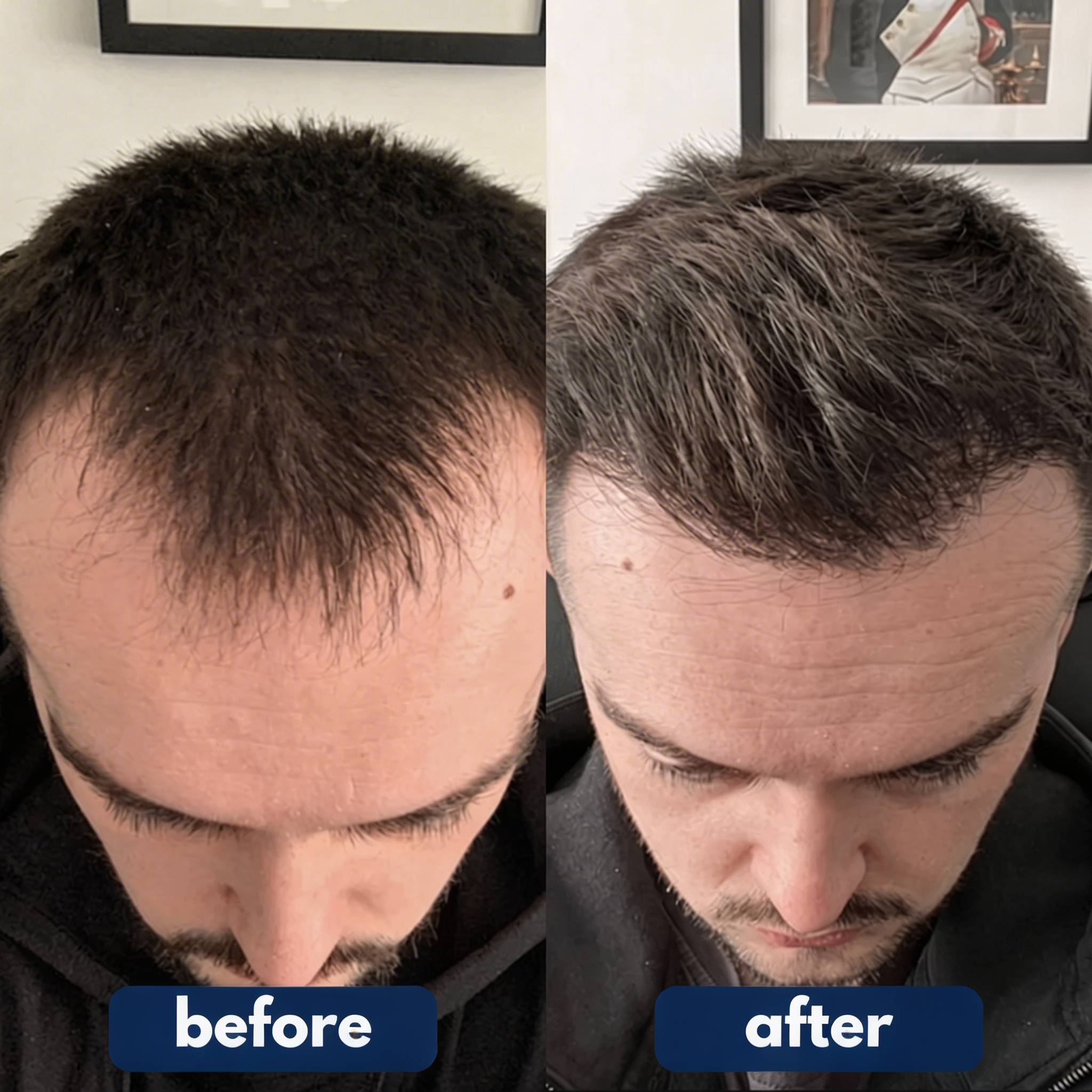 SEREVIA - HAIR GROWTH SERUM